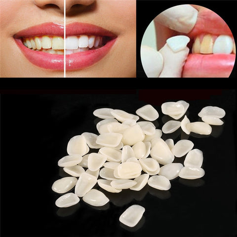 70pcs/bag Dental Ultra-Thin Resin Teeth Veneers Anterior A1 A2 Dental Temporary Crown Teeth Dentist Materials Dental Tools