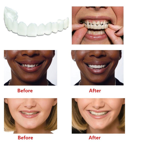 Effective Orthodontic Dental Appliance Trainer Tooth Orthodontic Braces Alignment Braces For Teeth Straight Alignment