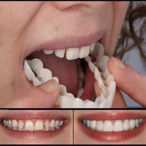 Oral Hygiene for Bad Teeth Smile Veneer No-Toxic Practical Plastic Smile Fake Tooth Cover Orthodontic Braces